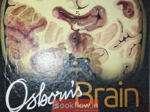 Osborn Brain 3rd Ed