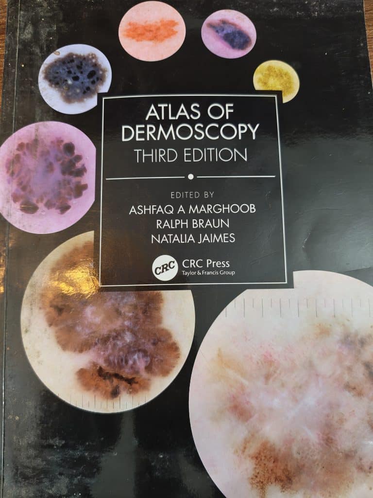 Atlas of Dermoscopy Third Edition