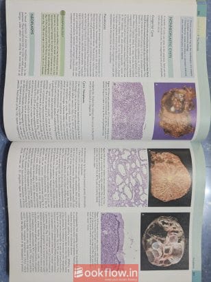 Robbins & Cotran Pathologic Basis of Disease
