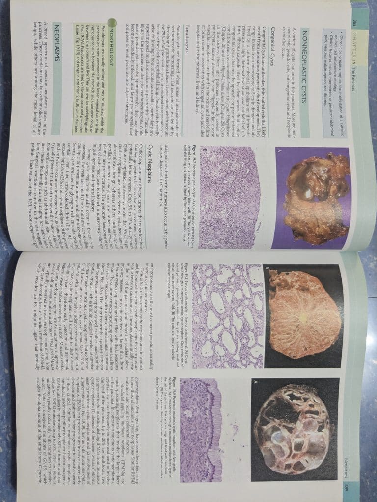 Robbins & Cotran Pathologic Basis of Disease photo 2