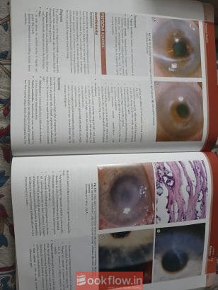 Kanski’s Clinical ophthalmology
