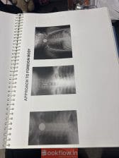 Btr cerebellum 19 subjects