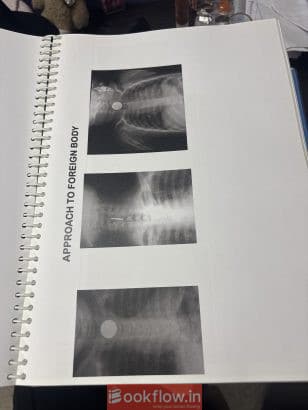 Btr cerebellum 19 subjects