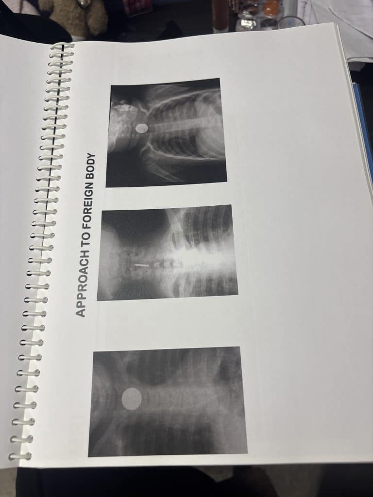 Btr cerebellum 19 subjects
